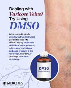 Dr mercola varicose veins