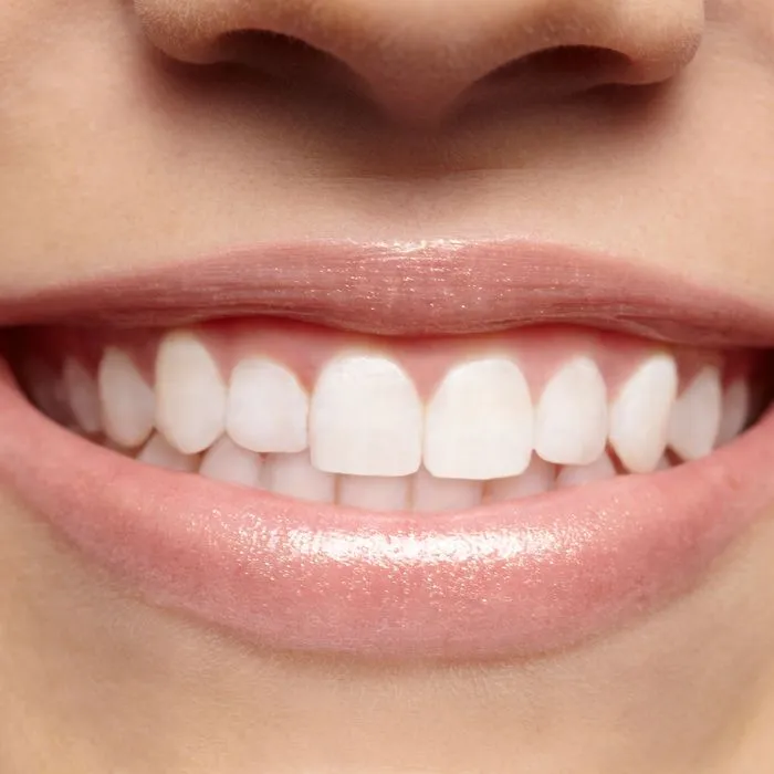Ff55e471f1820f25d709327f92c8d6b54e 27 teeth.rsquare.w700