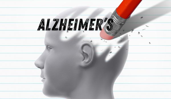 Alzheimer's