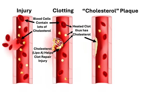 Cholesterol